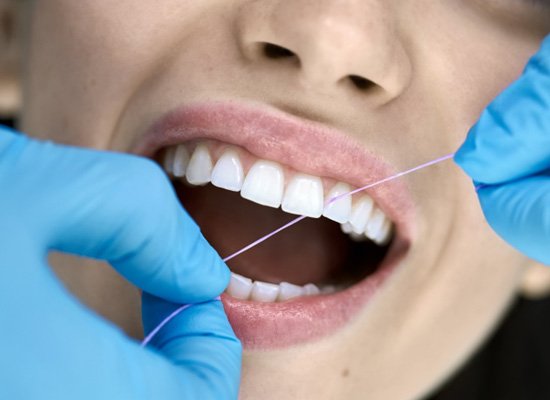 Dental hygienist flossing patient's teeth
