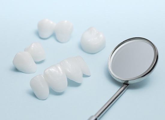 Dental crowns and bridges prior to placement