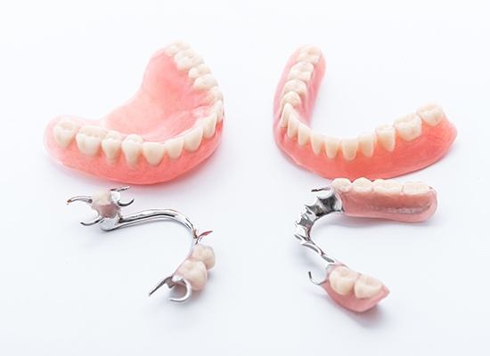 Four types of dentures