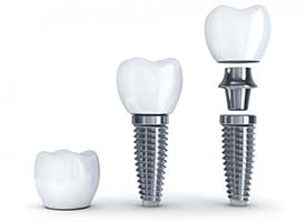 dental implant post, abutment, and crown