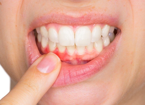 Closeup of red gum tissue