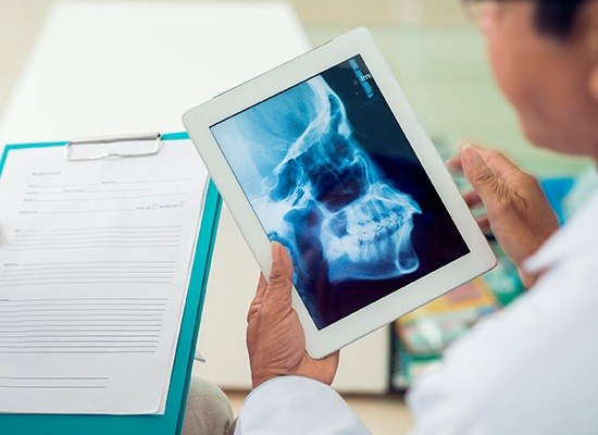 Dentist looking at skull and jawbone x-rays