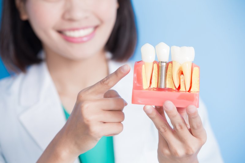 Dentist holding model of dental implants